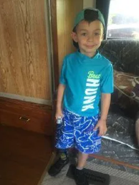 Aiden的旋转成形术：Paley医生如何改变孩子的未来